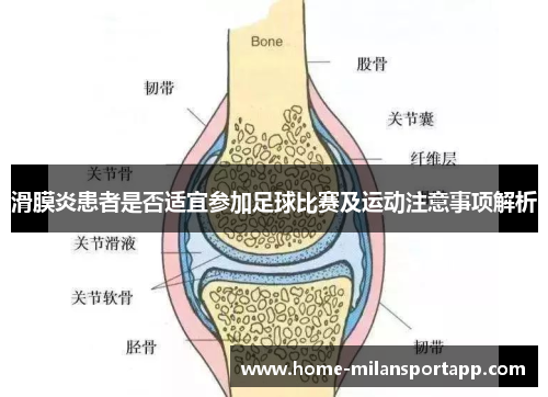 滑膜炎患者是否适宜参加足球比赛及运动注意事项解析